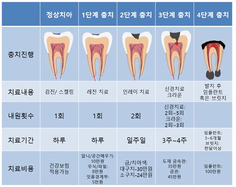 치과 치료 비용