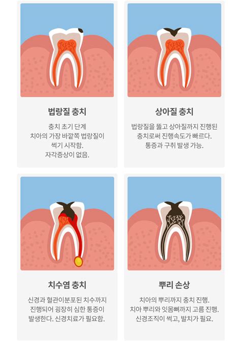 치아 통증 종류