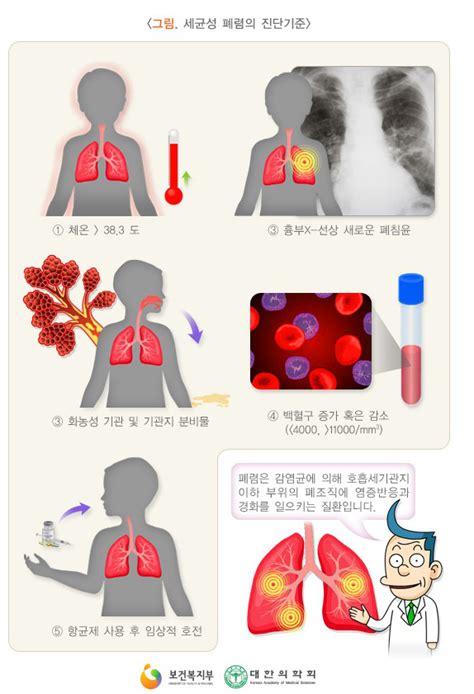 폐렴 치료