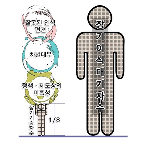 한국의 생체장기 기증제도에 대한 윤리적 고찰 - 장기 이식