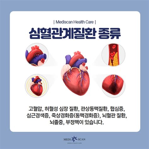 허혈성 심장 질환 종류