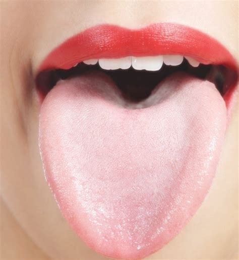 혀 사진