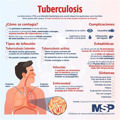 ﻿¿cómo se incluye la tuberculosis actual para el empleo?