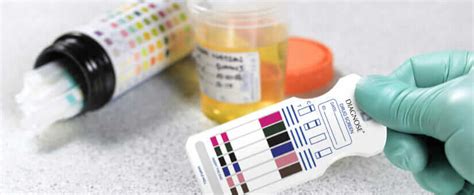﻿¿hace healtheast pruebas de detección de drogas antes del empleo?