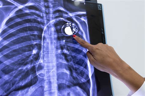﻿¿por qué elegir la radiografía como carrera?