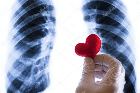 ﻿cardiólogo vs. radiólogo