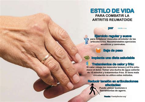 ﻿trabajos para personas con artritis