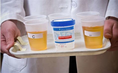  A diluted urine drug test is usually done by consuming excessive amounts of water before testing or adding water to the urine sample to dilute the concentration of substances in it