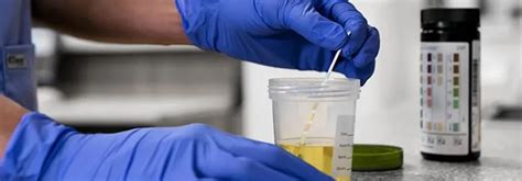 A diluted urine test can sometimes be detected more easily than other types of cheating, based on the dilution of other prime compounds in the urine that are detected on the test