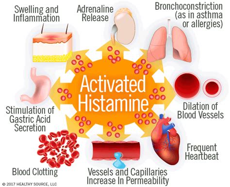  A sudden histamine release can cause swelling, vascular changes and inflammation