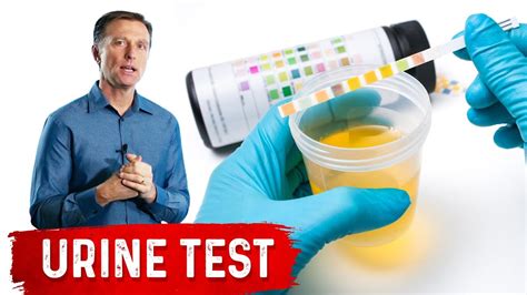  A typical at-home test requires a urine sample