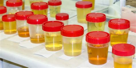  A urine test detects the presence of drugs in various panels in the body used for the last few days
