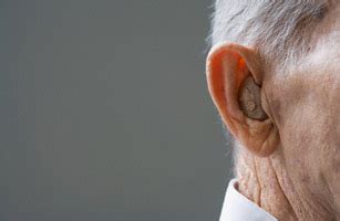  Acquired deafness is usually permanent but may improve over time without intervention