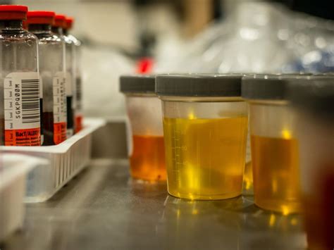  Additional tests will likely reveal that the urine sample was adulterated