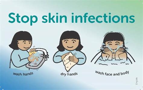  Additionally, their wrinkles should be cleaned and dried regularly to prevent skin infections