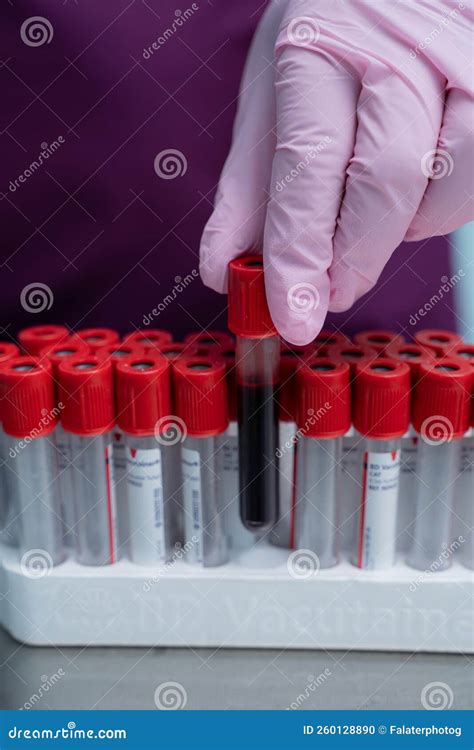  After the needle is inserted, a small amount of blood will be collected into a test tube or vial