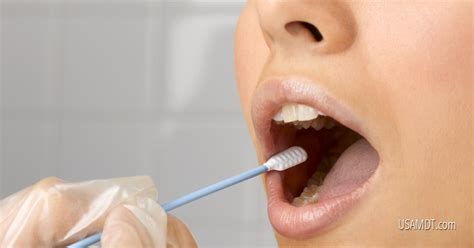  Alternatively, instead of a swab, an absorbent strip can be used, which is placed between the gums and lower cheek and which will change color after a few minutes if the results are positive