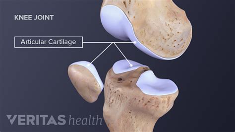  As your dog ages, the protective cartilage surfaces of the joints become thinner, and the cartilage cells begin to die