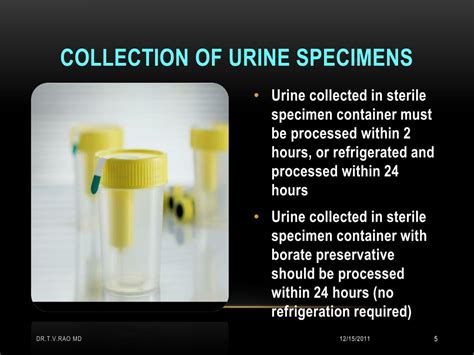  Because of the incomplete systemic distribution of MA, urine specimens collected within the first 5 h of d-MA-d0 dosing were not used to train the classifier but were used as test data
