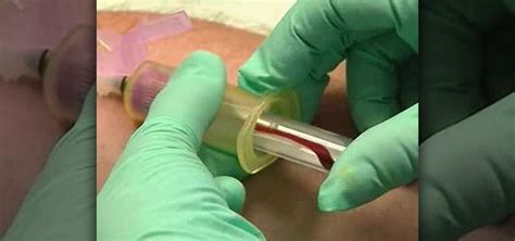  Blood samples were obtained via jugular venipuncture and transferred to a coagulation tube for 20 min