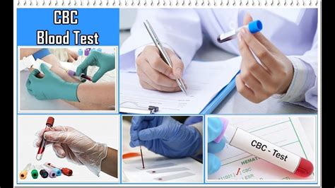  Blood testing is primarily done in emergency situations and is typically used to detect ethanol levels