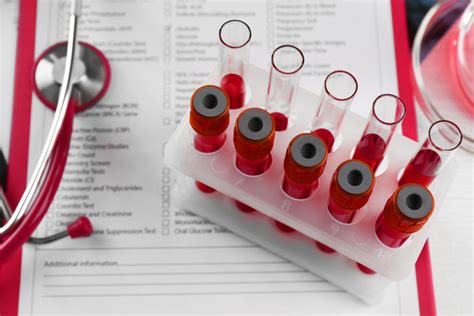  Blood tests are better indicators of drug overdose and abuse than urine
