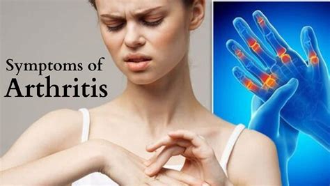  Both suffer from joint stiffness and arthritis like symptoms