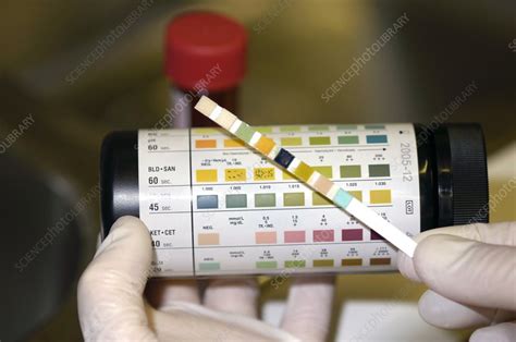  Both urine tests and blood tests typically take between one and five business days