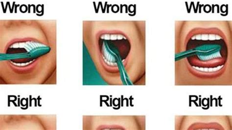  Brush its teeth 2 — 3 times a week and check the eyes for redness and discharge