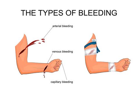  But… It can really hurt you or make you bleed! Understanding bite inhibition means they know how to control the power of their play bites and how hard or soft they nip you