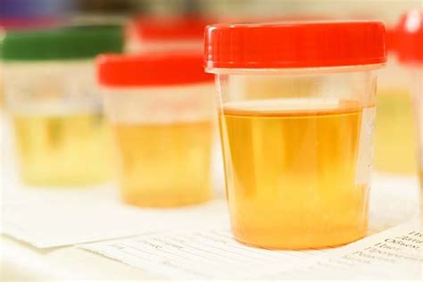  Can a Drug Test Detect Gender? A lab will be able to differentiate between male and female urine