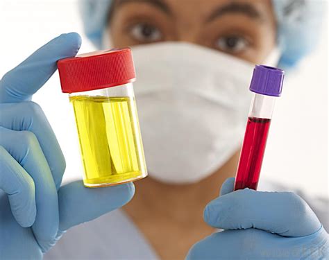  Cheating usually involves adding a substance to the urine to affect the test results