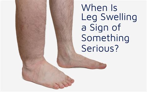  Check for any visible signs of swelling