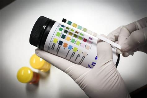  Chemical adulterants are typically added to urine samples to make them appear clean when tested