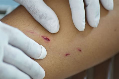  Clean the bite wound thoroughly and schedule a checkup with your veterinarian as soon as possible after the bite occurs