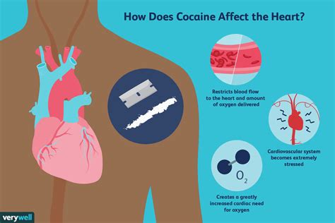  Cocaine can damage the heart muscle as well as cause inflammation of the inner heart tissues