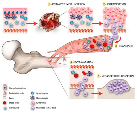  Common cancers include hemangiosarcoma and bone, lung, and intestinal cancers