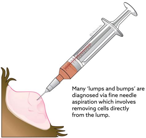  Diagnosis involves a Fine Needle Aspiration FNA procedure, where your vet takes a small tumor sample via a needle and syringe and examines it under a microscope