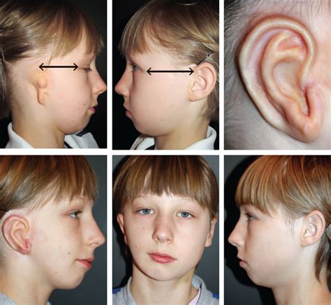  Drop ears: The ears are set high, level with the upper line of the skull, accentuating the skulls width