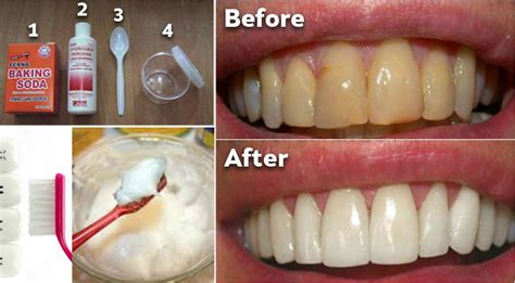  Dry kibble is helpful in removing plaque and promoting general dental hygiene