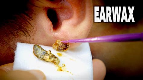  Ears should be swabbed of excess dirt and wax, and teeth ought to be brushed on a weekly basis