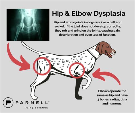  Elbow and hip dysplasia are both common
