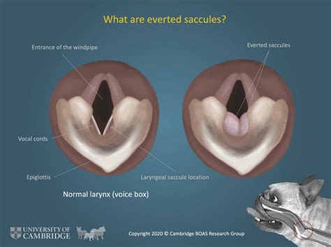  Everted laryngeal saccules: Little pouches in the throat can turn inside out due to the increased effort to breathe, further blocking the airway