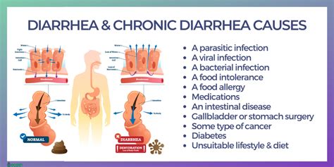  Excessive consumption can result in stomach upsets and severe diarrhea