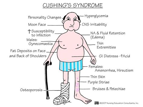  Finally, diseases such as Cushing