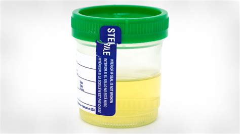  For a urine test, you simply urinate into a cup