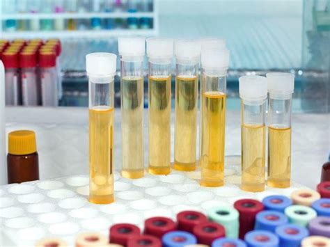  For occasional use of up to three times weekly, metabolites can be detected in a urine test up to three days after your last usage