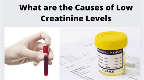  For this reason, a low creatinine level is a red flag to urine sample adulteration because excessive fluid consumption affects creatinine levels in the urine sample