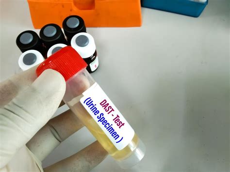  Genuine human urine! This test shows the presence of drugs and its metabolite in the hair sample