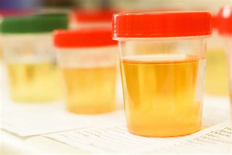  Genuine human urine! Urine samples for drug tests need to remain warm in order for them to be accepted and valid